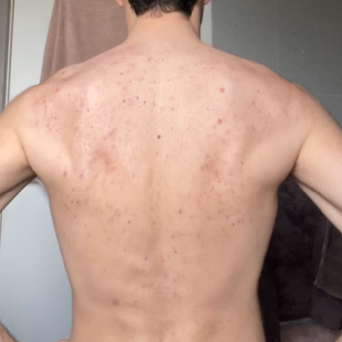 After transformation