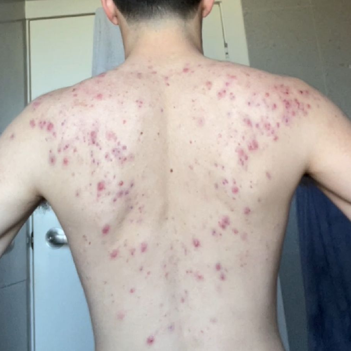 Before transformation